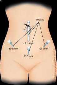 Fertility Centre in pcmc